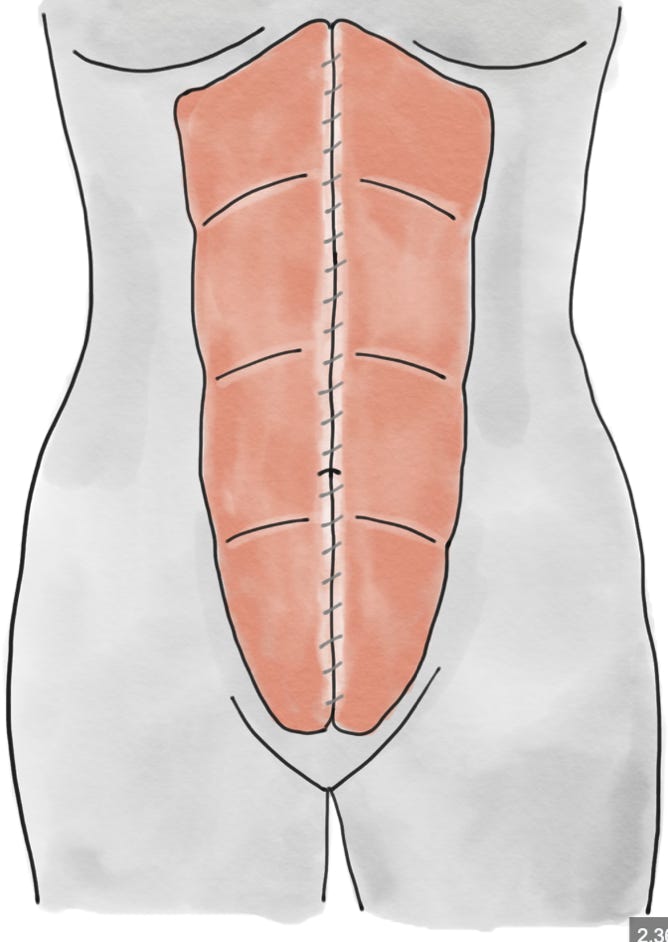 Rektusdiastase, Rückbildung, rektusdiastase rückbildung, rektusdiastase schliessen, kostenlose rückbildung, rückbildung kostenlos, rektusdiastaseübungen, rektusdiastase bauch, flacher bauch, flacher bauch übungen, flachen bauch bekommen,